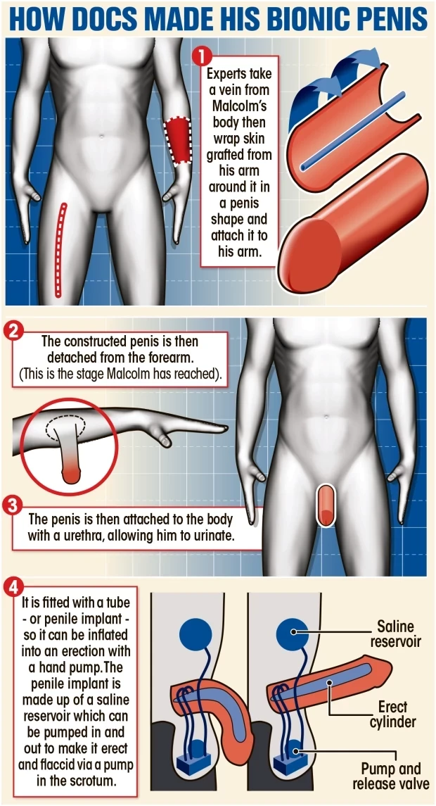 cm-graphic-p5.webp