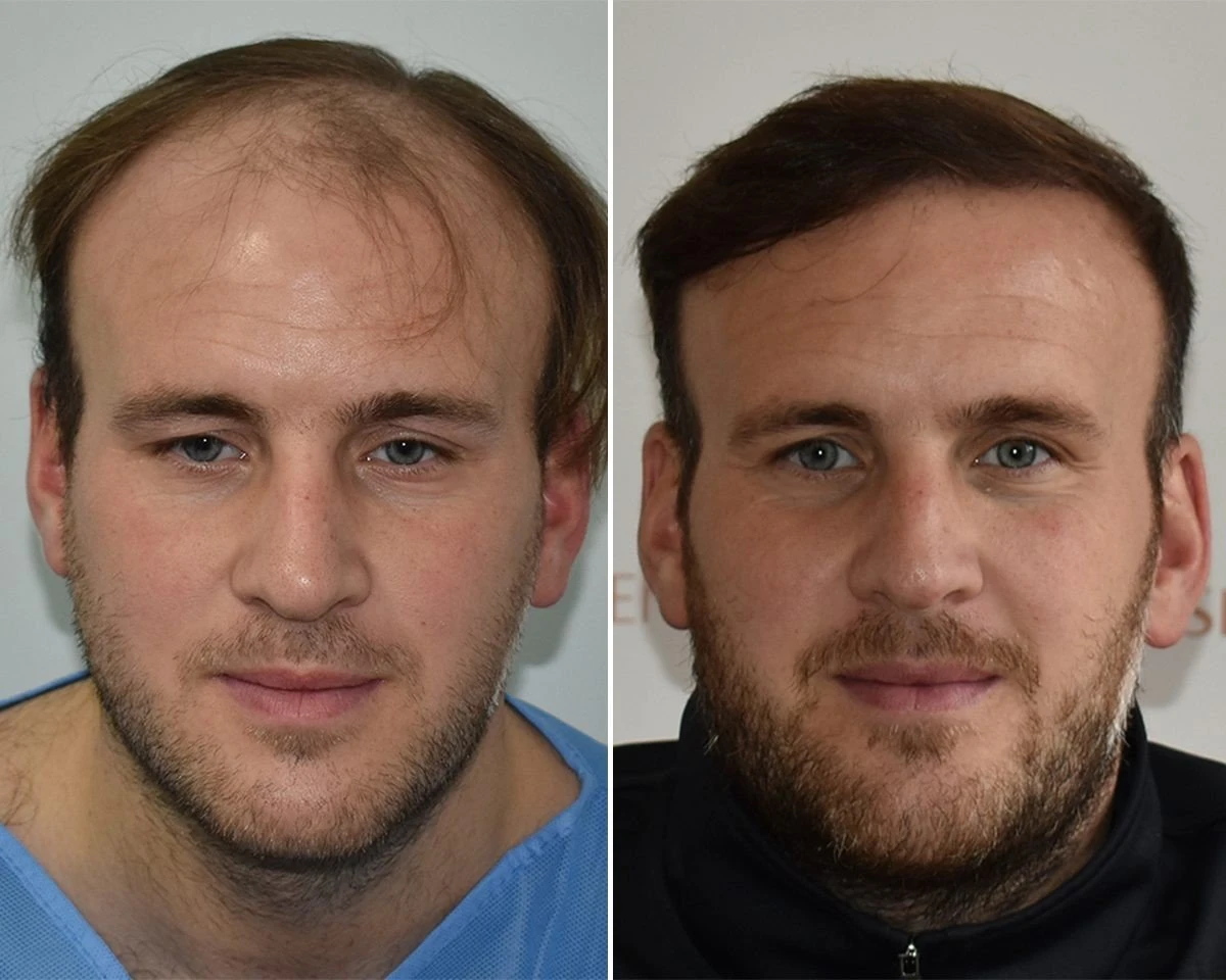 before-after1-2-4.jpg