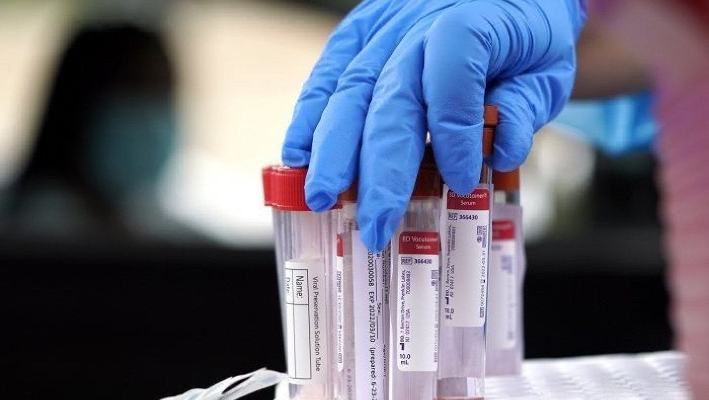 Οι Κινέζοι ήξεραν όμοιο στέλεχος με τον κορωνοϊό από το 2013!