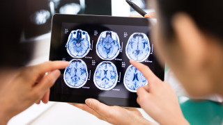 Μυστηριώδης νευρολογική ασθένεια έχει εμφανιστεί στον Καναδά