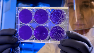 Aspergillus: Ποιος είναι ο μύκητας που «τρώει» το εσωτερικό μας